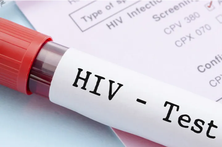 کانادا به سیاستی که متقاضیان مهاجرت و پناهندگان را مجبور به فاش کردن وضعیت اچ‌آی‌وی خود برای حامیانشان می‌‌کرد پایان داد